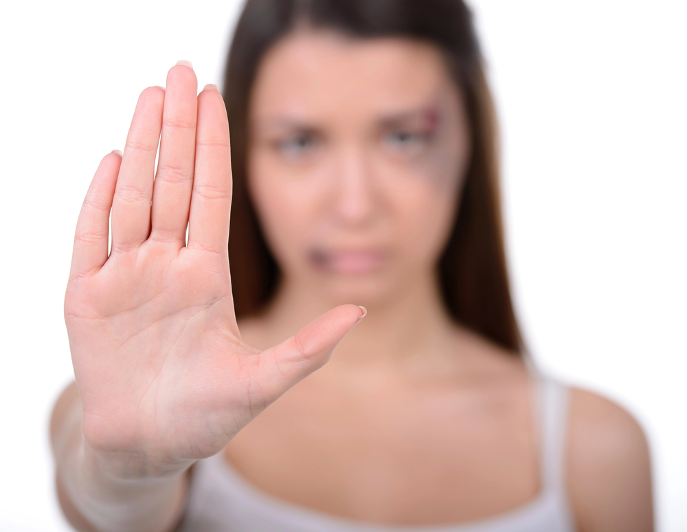 Woman with black eye holding up hand in "stop" motion